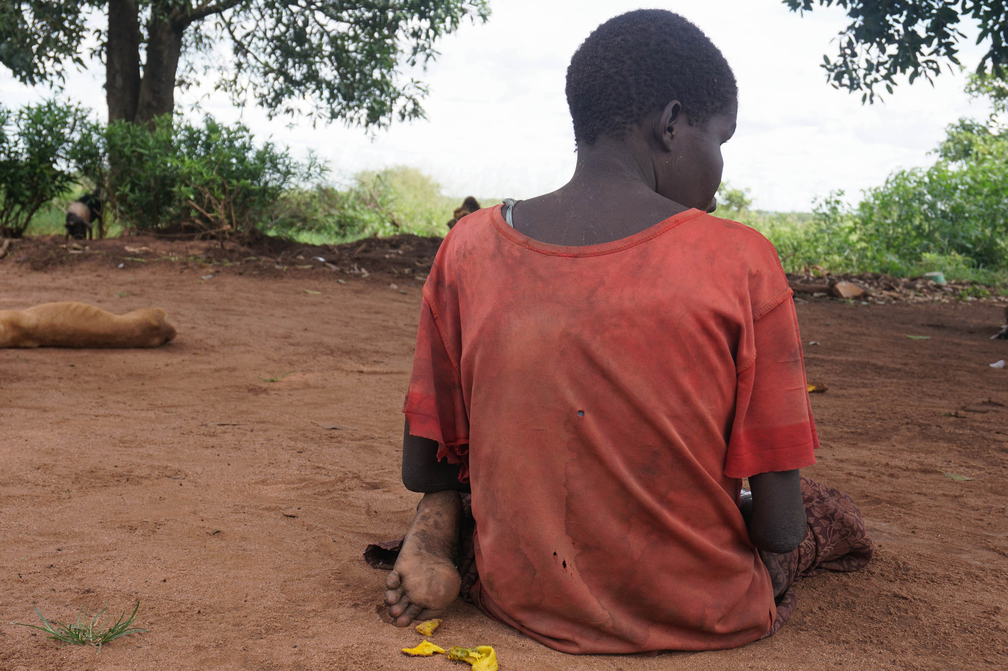 A ‘Mysterious Tropical Disorder’ Is Devastating Families in Northern Uganda